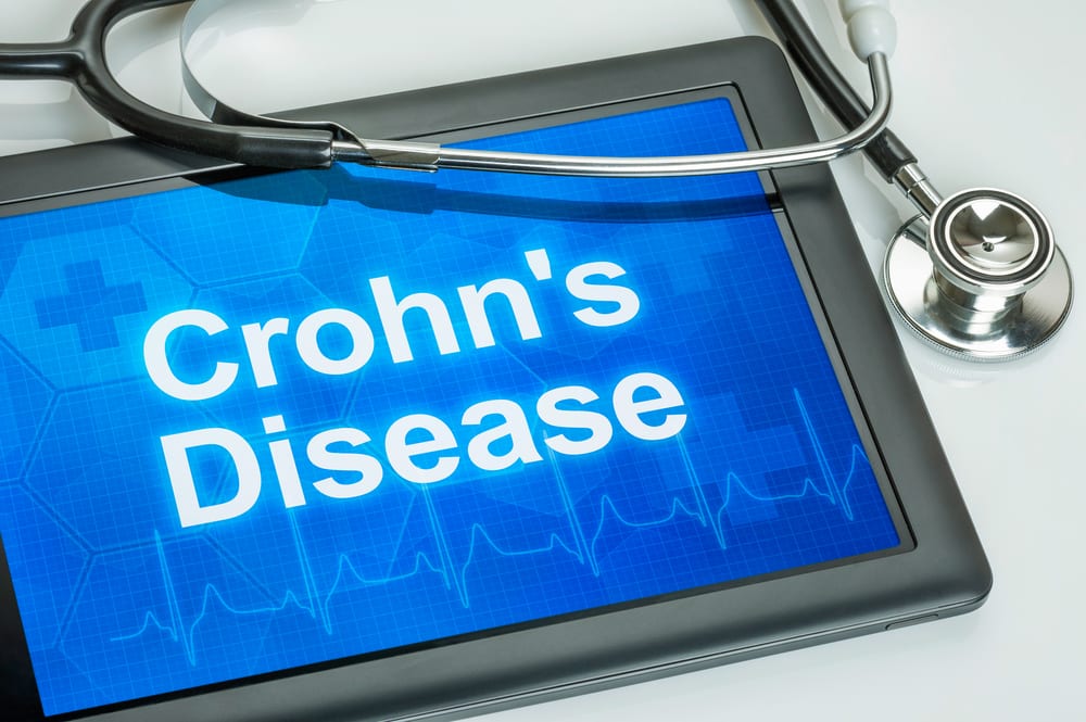 Crohn’s disease treatment Utah