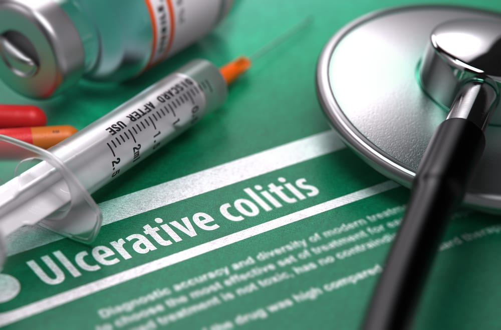 Ulcerative colitis treatment in Lehi, Utah